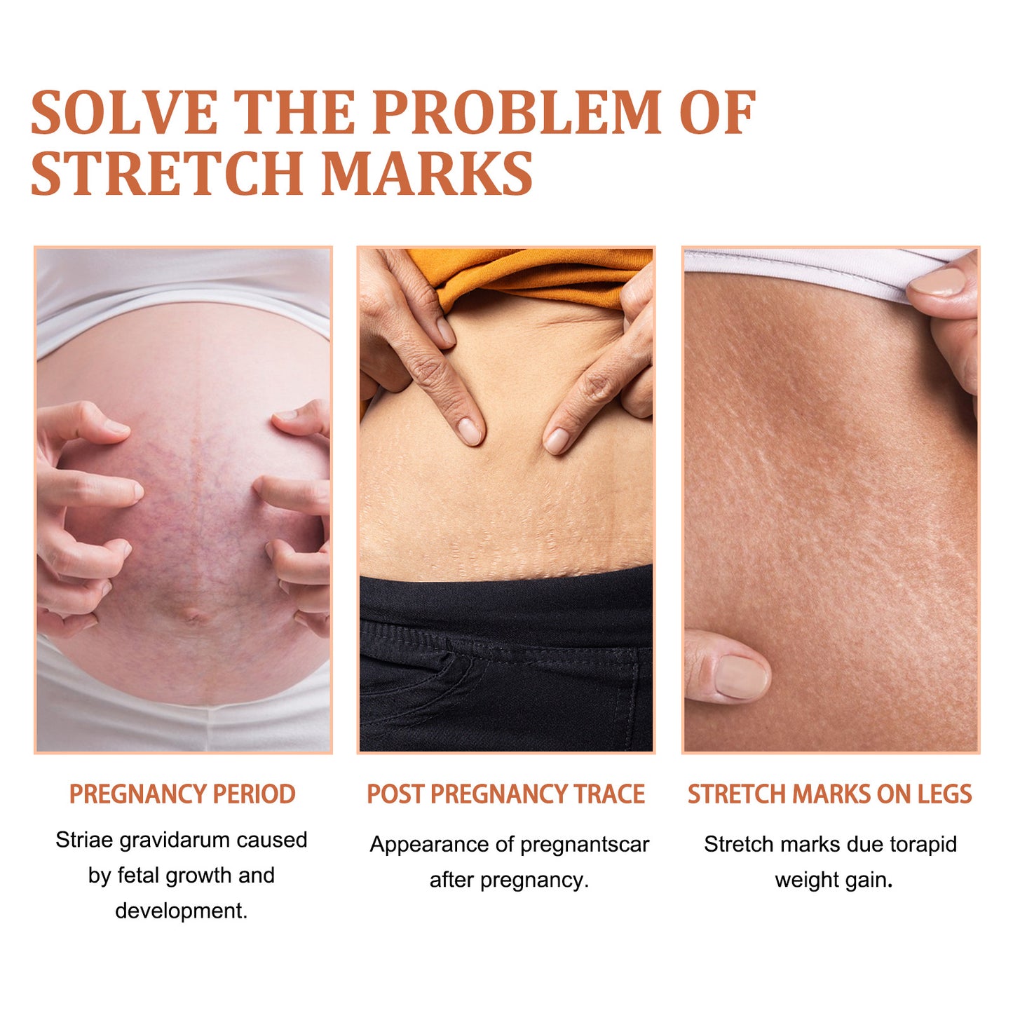 Scar Repair Smooth Skin Rejuvenation Neck Cream
