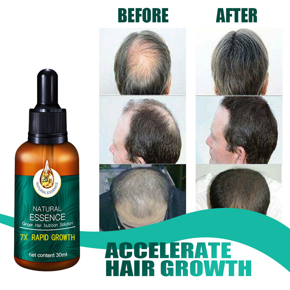 Foreign trade cross-border essential oil repair hair follicle essential oil 30ml essence for men and women
