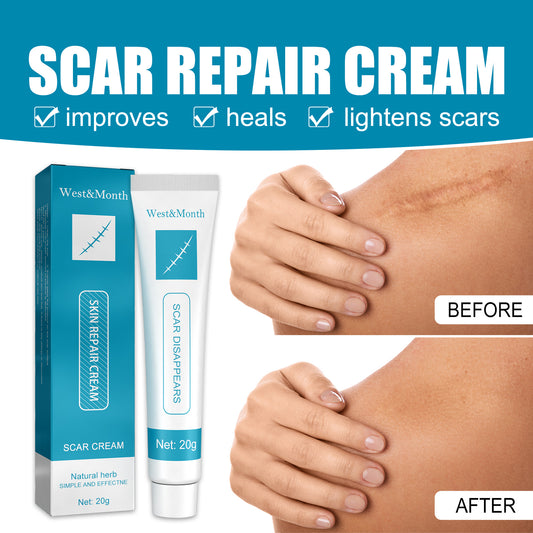West&Month scar repair cream scar cream fade hyperplasia pregnancy surgery burn scar skin repair